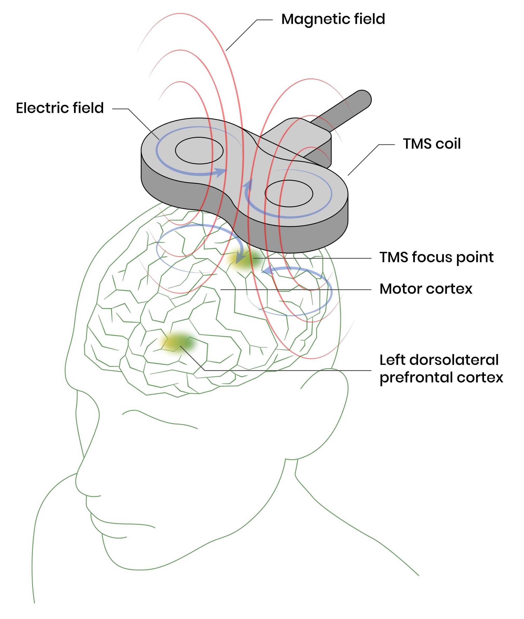 TMS therapy mechanism