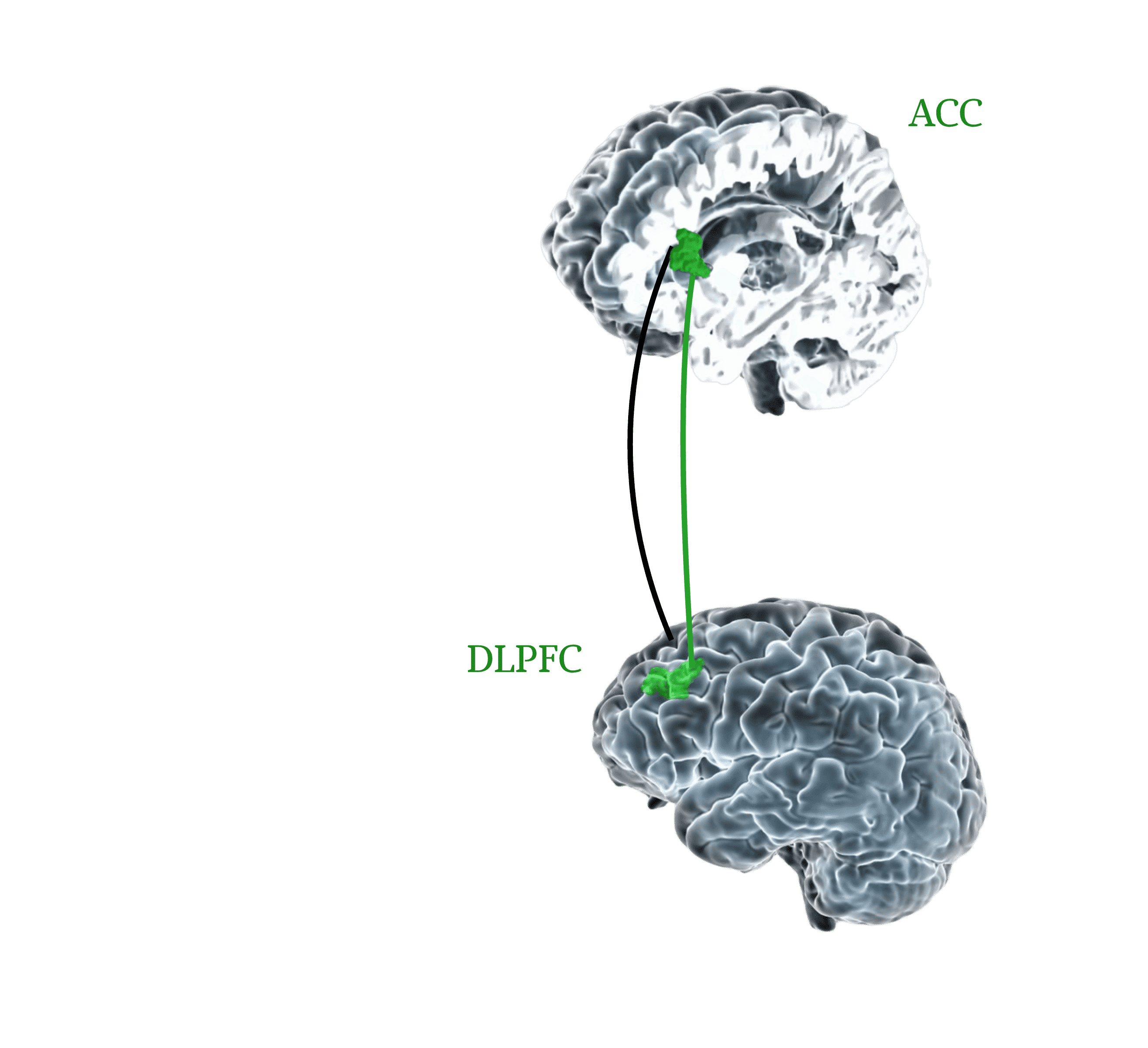 wyznaczanie miejsca stymulacji, protokół SAINT