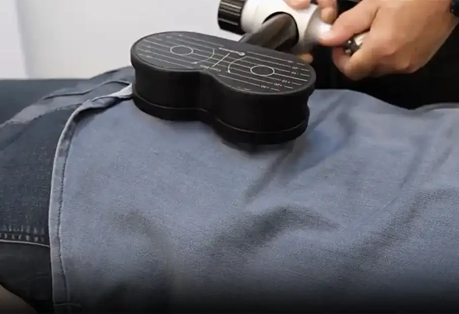 magnetyczna stymulacja obwodowa